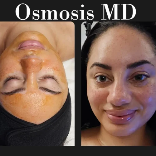 Naked-SKN-Aesthetics-Osmosis-MD-Skin-Care-gallery-a-in-The-Woodlands-TX